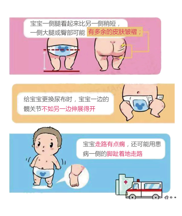 家长们请注意:你们知道小儿髋关节B超对宝宝的重要性吗?